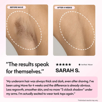 Mave IPL Hair Removal Handset